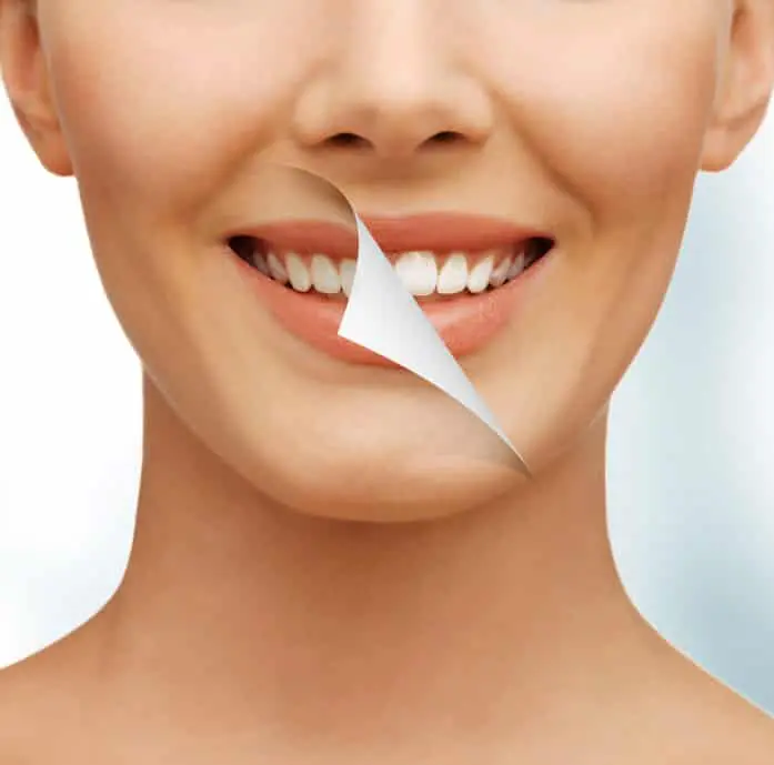 Dental Tips And Teeth Whitening Dental Tips And Teeth Whitening