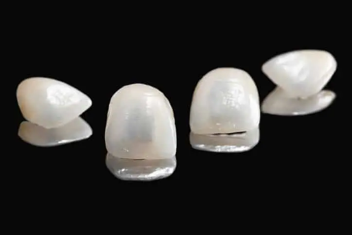 types of dental veneers