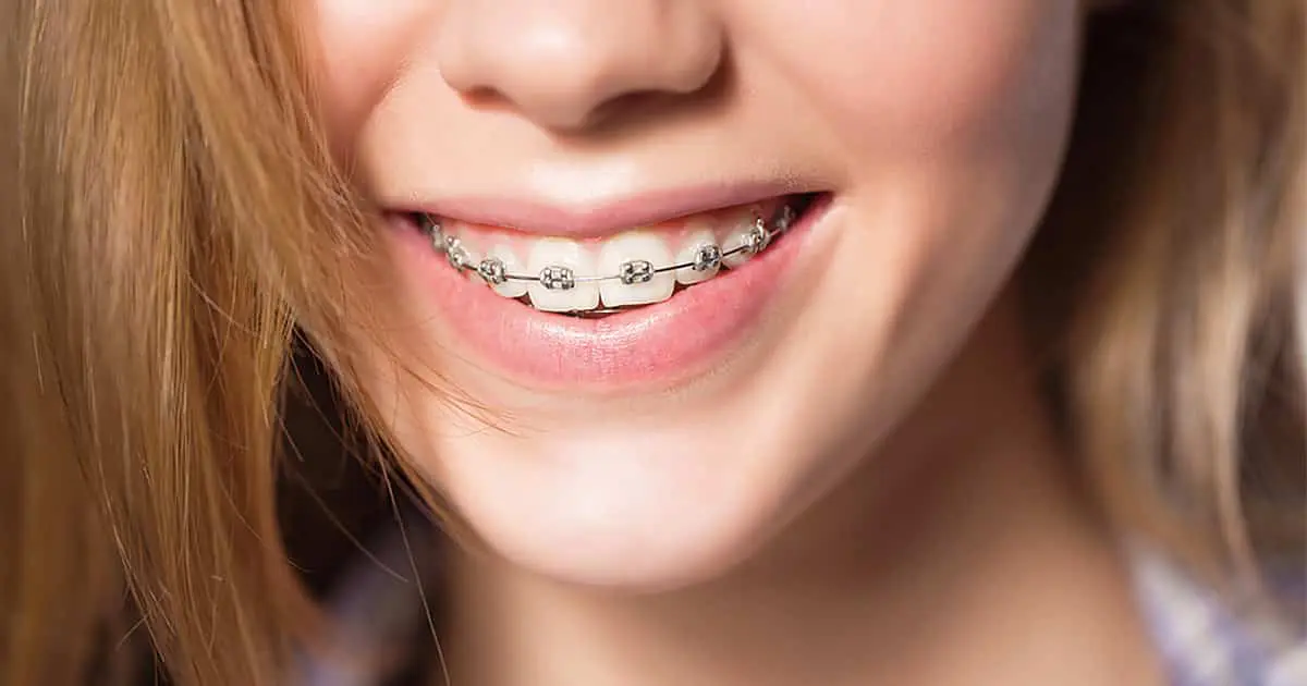 Orthodontics - Chesterfield, MI