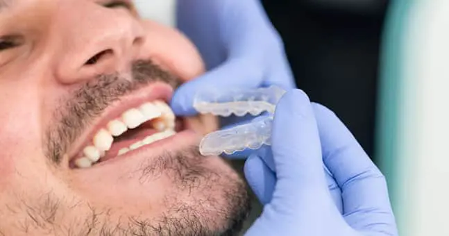 Clear Braces near New Baltimore MI