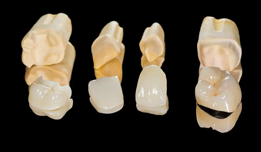 Dental Ceramic Crowns
