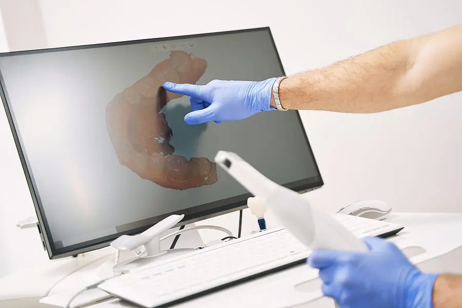 Male Dentist Hand Pointing At Computer Display With Dental 3d Sc