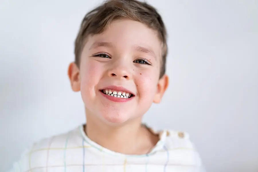 Portrait Of A Cute Boy Smiling With White Healthy Teeth. Emotion
