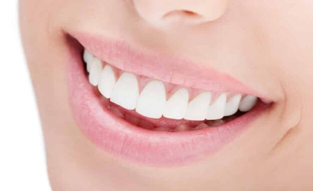Is Teeth Whitening Permanent?