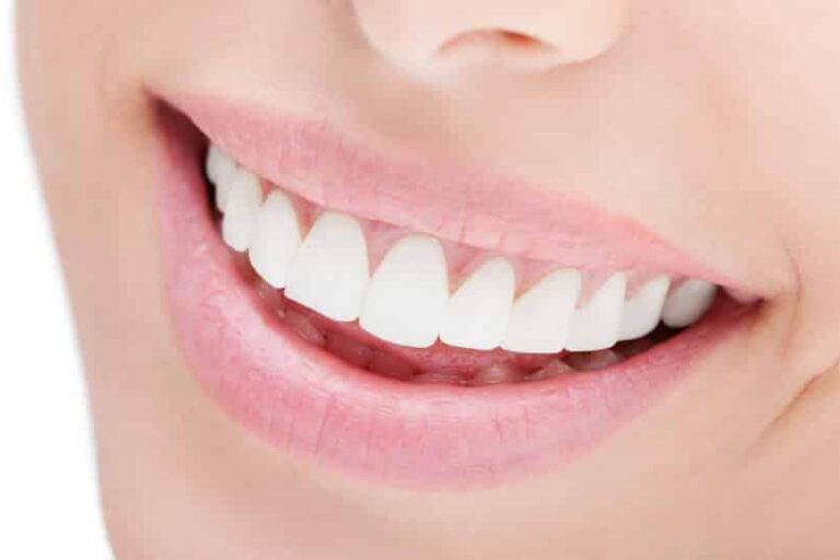 Is Teeth Whitening Permanent?