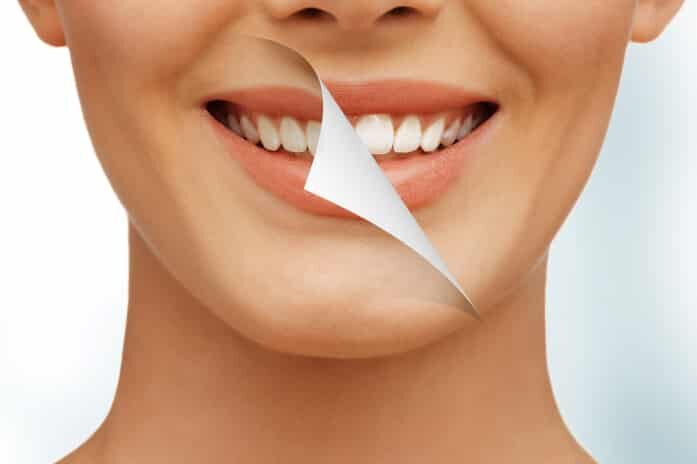 Dental Tips And Teeth Whitening
