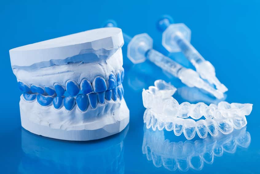 Teeth Whitening Kits And Trays