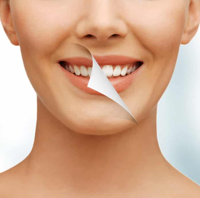 Dental Tips And Teeth Whitening