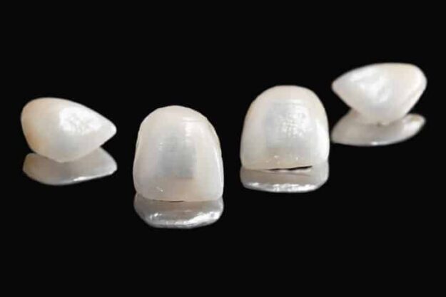 types of dental veneers types of dental veneers