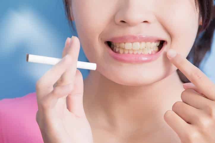 How to Remove Smoking Stains on Teeth