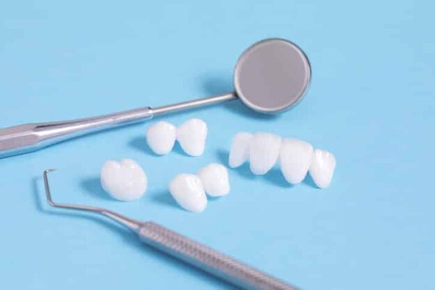 types-of-dental-bridges